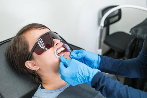 Best Knocked-Out Tooth (Avulsed Tooth) Treatment in Tipp City, OH