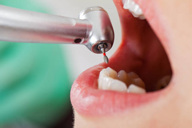 Best Emergency Treatment for Oral Infections in Tipp City, OH